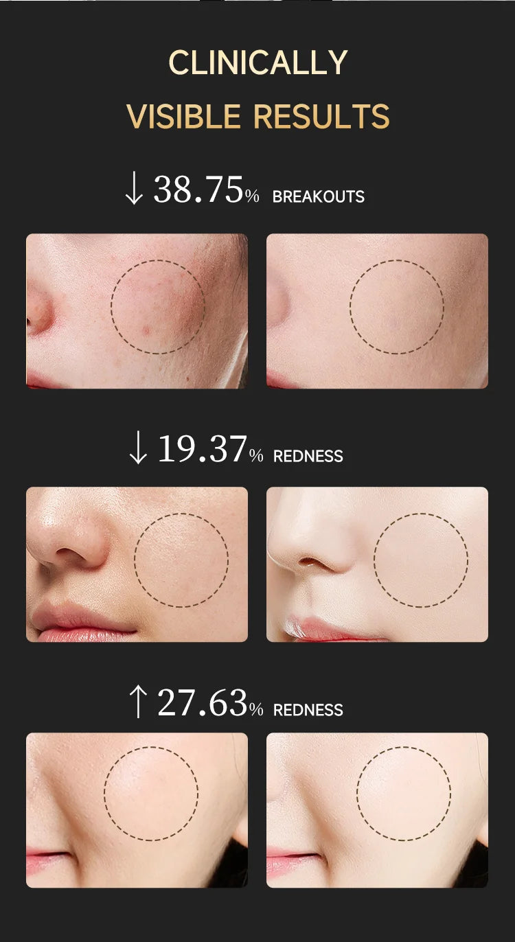 LED Red Light Therapy Face Mask with Vibration Massage 4 Light Modes Infrared Beauty Treatment for Skin Care Anti-Aging