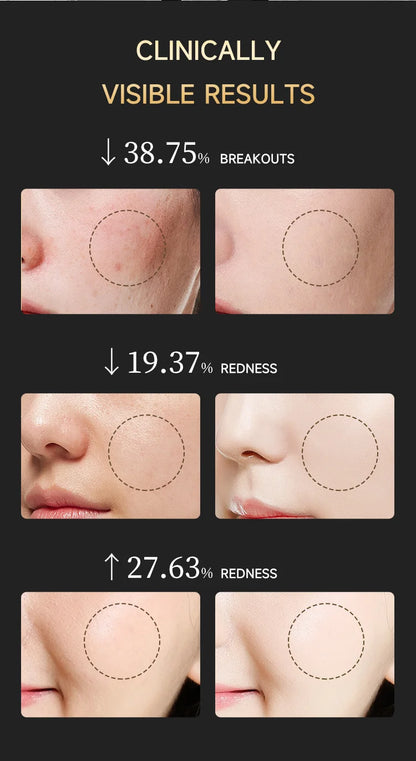 LED Red Light Therapy Face Mask with Vibration Massage 4 Light Modes Infrared Beauty Treatment for Skin Care Anti-Aging